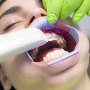 Cleaning and maintenance of orthodontic